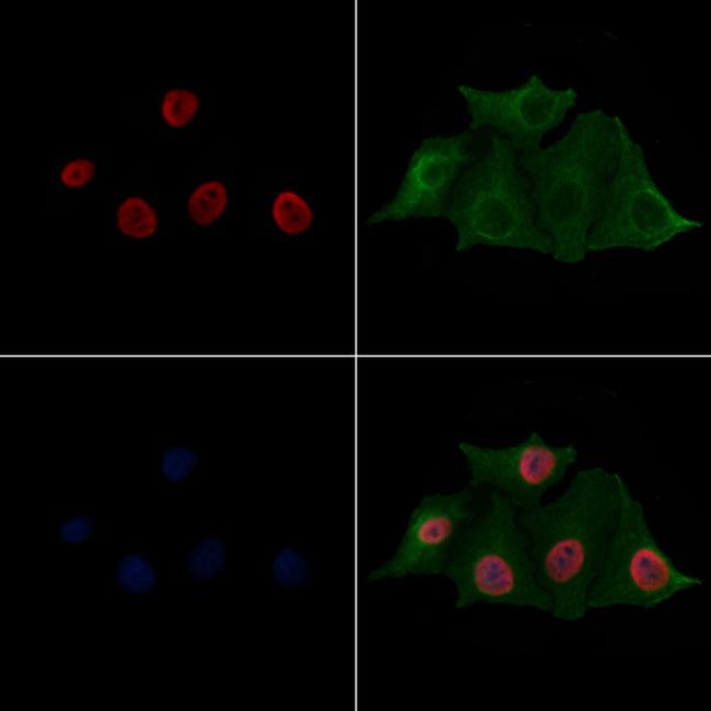 H2BK20ac Antibody in Immunocytochemistry (ICC/IF)