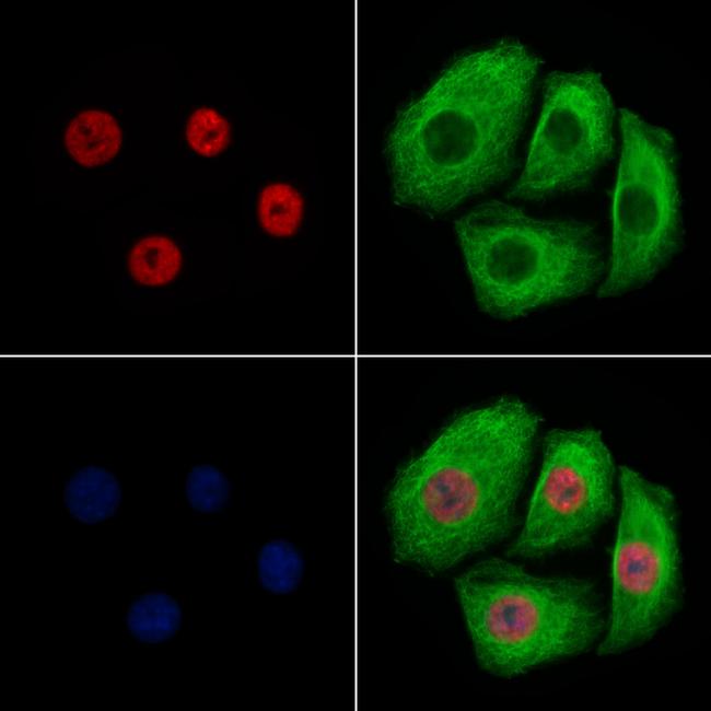 Histone H3ac (pan-acetyl) Antibody in Immunocytochemistry (ICC/IF)