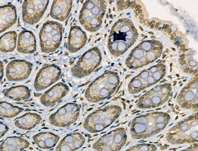 Acetyl-NFkB p65 (Lys314, Lys315) Antibody in Immunohistochemistry (Paraffin) (IHC (P))