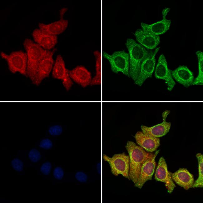 CD2AP Antibody in Immunocytochemistry (ICC/IF)