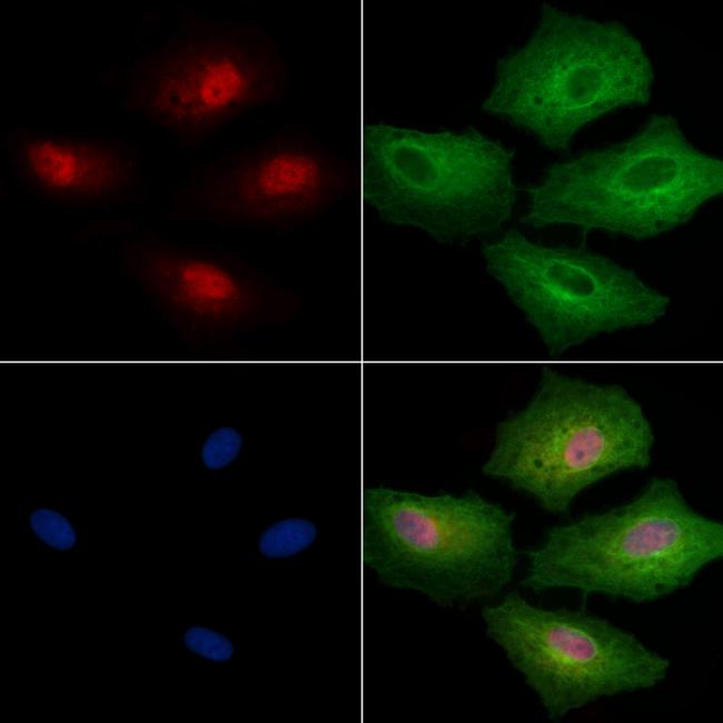 EHMT1 Antibody in Immunocytochemistry (ICC/IF)