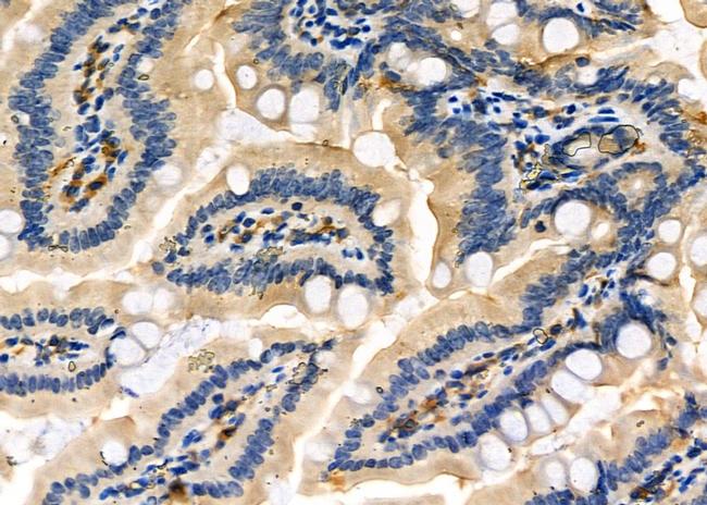 FN3K Antibody in Immunohistochemistry (Paraffin) (IHC (P))