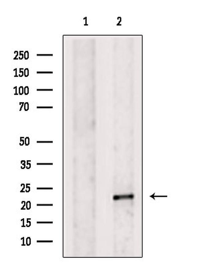 ITGB1BP1 Antibody in Western Blot (WB)