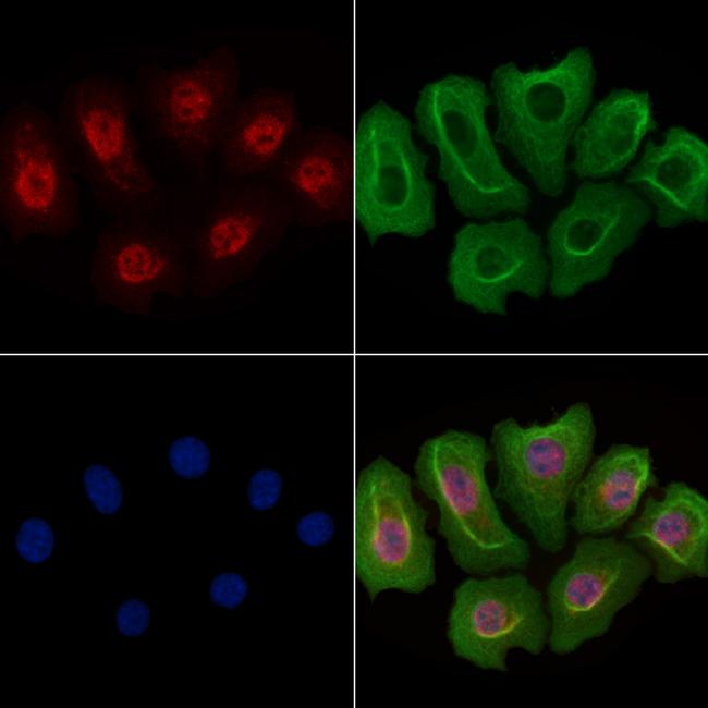 JMJD1B Antibody in Immunocytochemistry (ICC/IF)