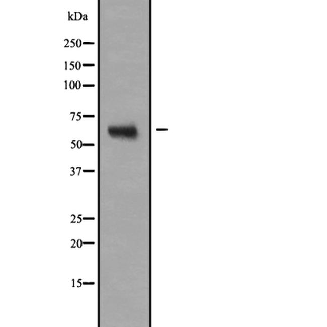 NR2C2 Antibody in Western Blot (WB)