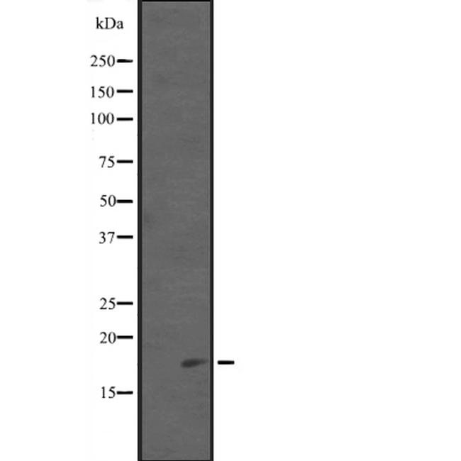 PDCD5 Antibody in Western Blot (WB)