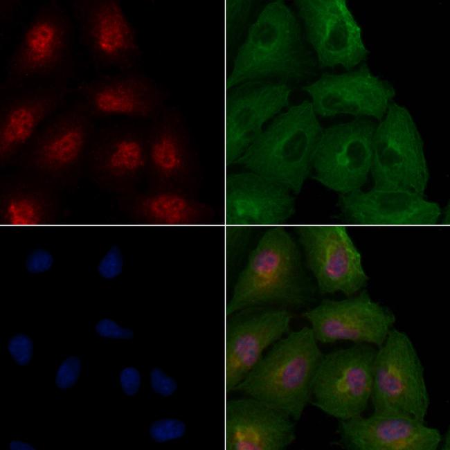 TAF7 Antibody in Immunocytochemistry (ICC/IF)