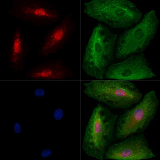 TBR1 Antibody in Immunocytochemistry (ICC/IF)