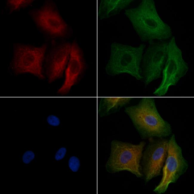 TNNT3 Antibody in Immunocytochemistry (ICC/IF)