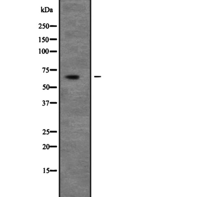 UNC5C Antibody in Western Blot (WB)