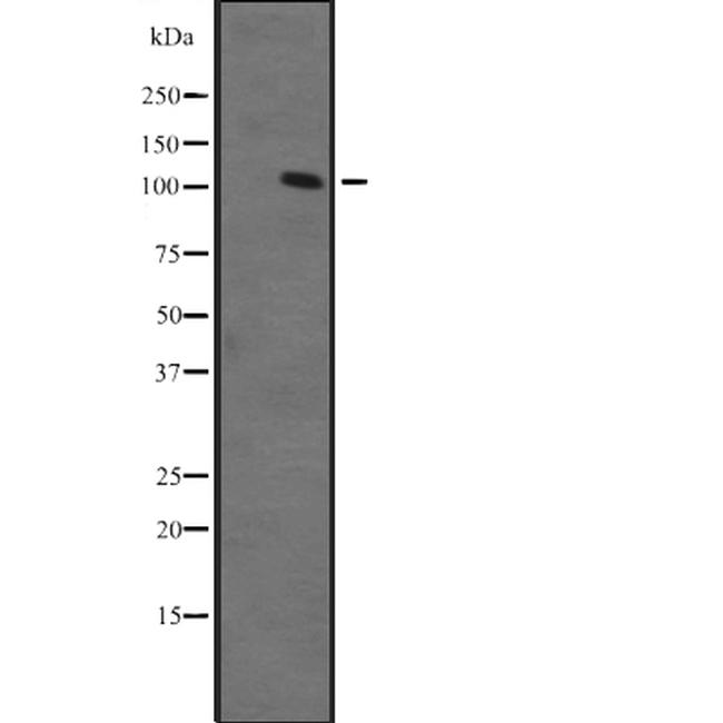 ZFPM1 Antibody in Western Blot (WB)