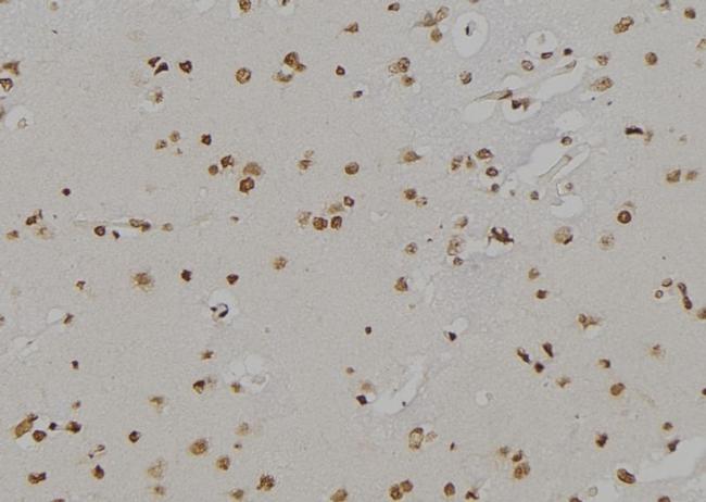 ALOX5 Antibody in Immunohistochemistry (Paraffin) (IHC (P))