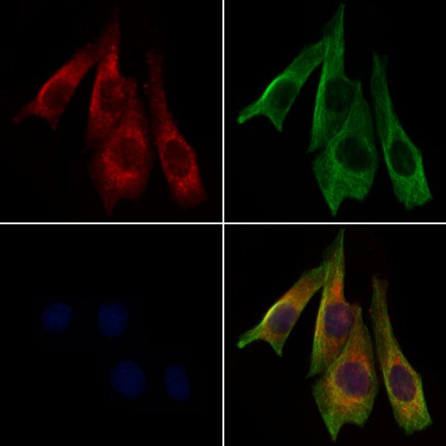 ABCD2 Antibody in Immunocytochemistry (ICC/IF)