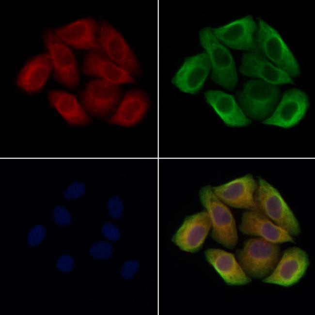 ASM Antibody in Immunocytochemistry (ICC/IF)