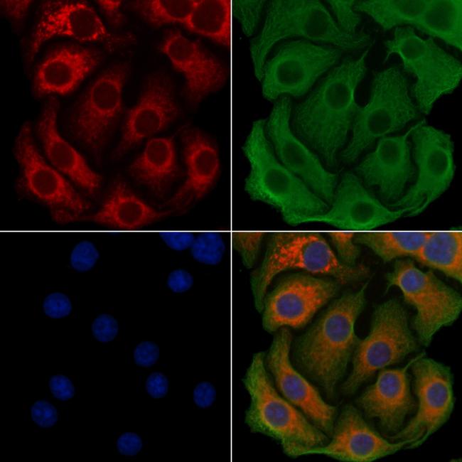 ACSL3 Antibody in Immunocytochemistry (ICC/IF)