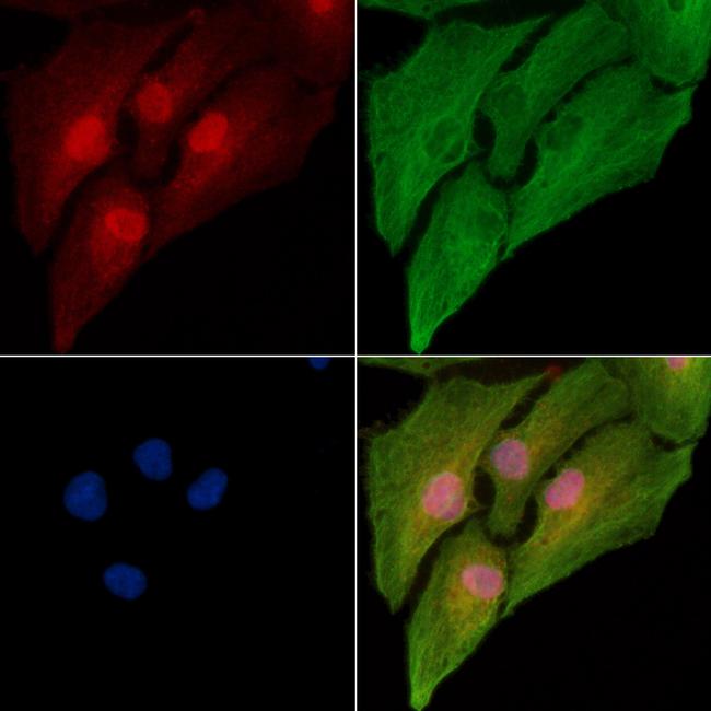 alpha-1b Adrenergic Receptor Antibody in Immunocytochemistry (ICC/IF)