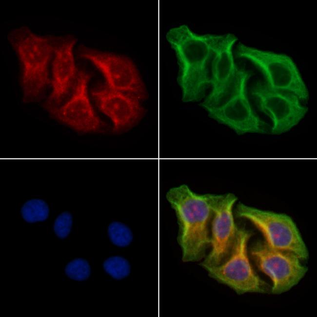 AKAP4 Antibody in Immunocytochemistry (ICC/IF)