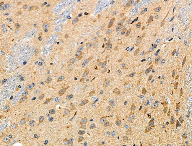 ALDH1A2 Antibody in Immunohistochemistry (Paraffin) (IHC (P))