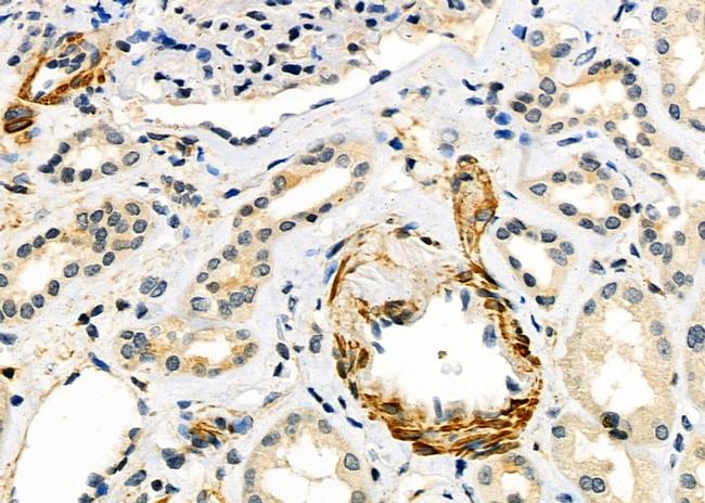 ALDH1A3 Antibody in Immunohistochemistry (Paraffin) (IHC (P))