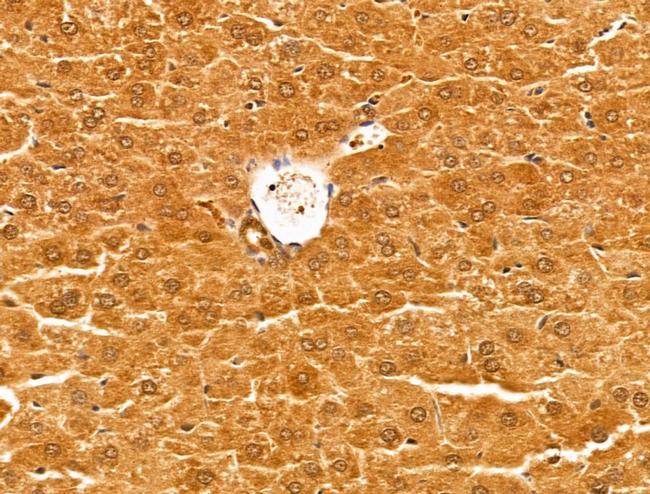 ALDH9A1 Antibody in Immunohistochemistry (Paraffin) (IHC (P))