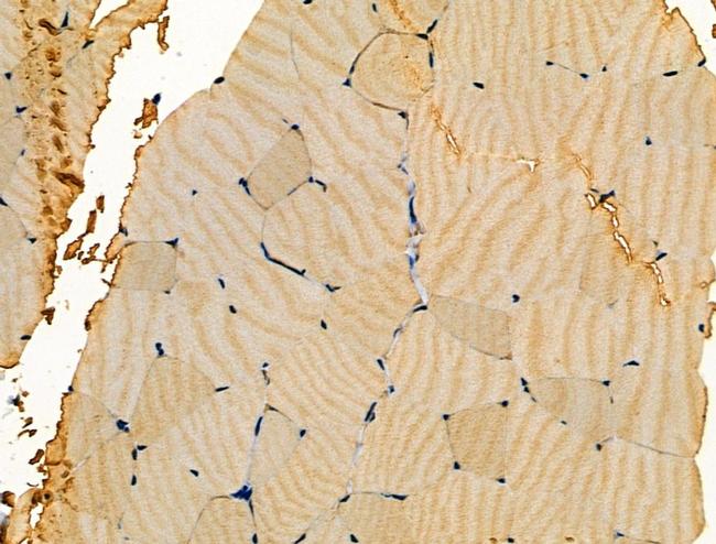 Aldolase Antibody in Immunohistochemistry (Paraffin) (IHC (P))