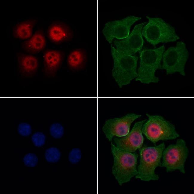 Aes Antibody in Immunocytochemistry (ICC/IF)