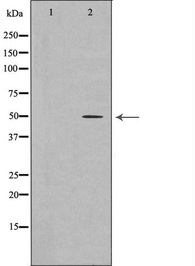 AP2M1 Antibody in Western Blot (WB)