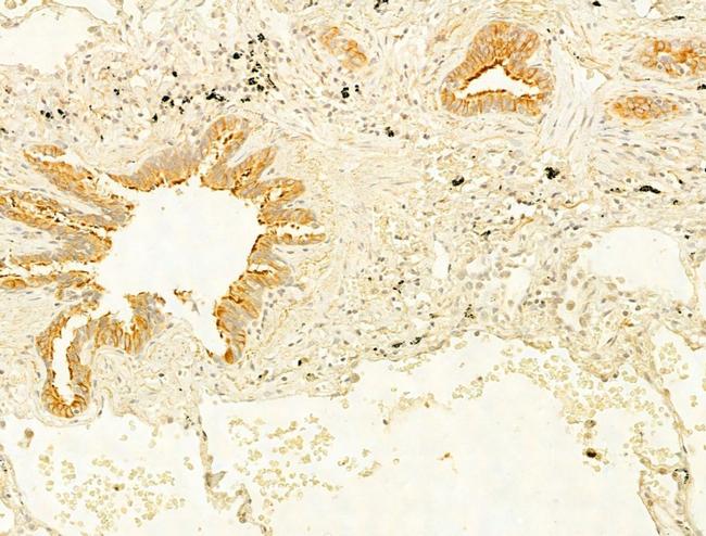 Protein APC Antibody in Immunohistochemistry (Paraffin) (IHC (P))