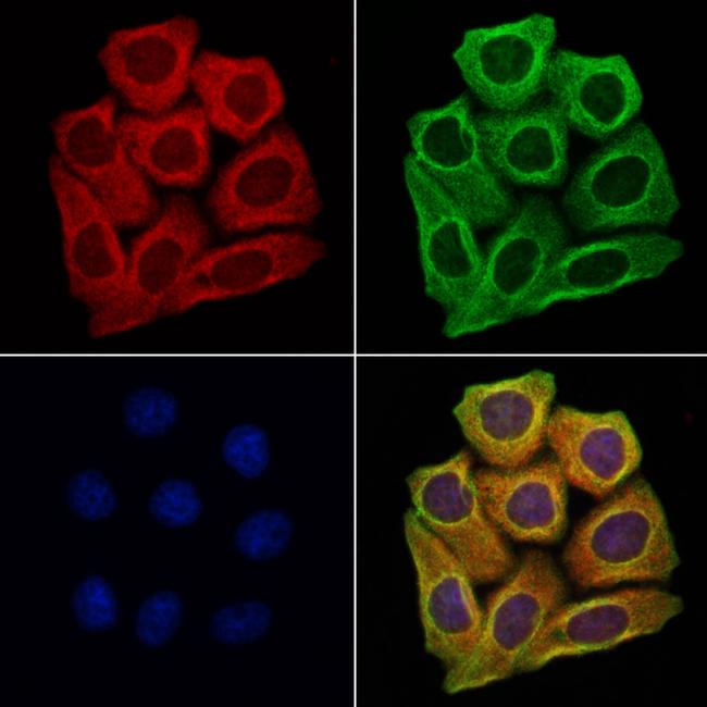 Aquaporin 9 Antibody in Immunocytochemistry (ICC/IF)