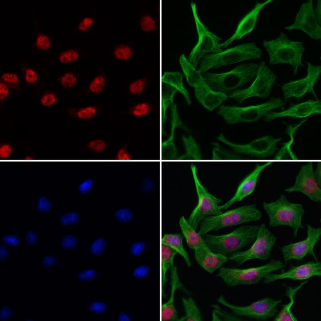 ARHGEF5 Antibody in Immunocytochemistry (ICC/IF)