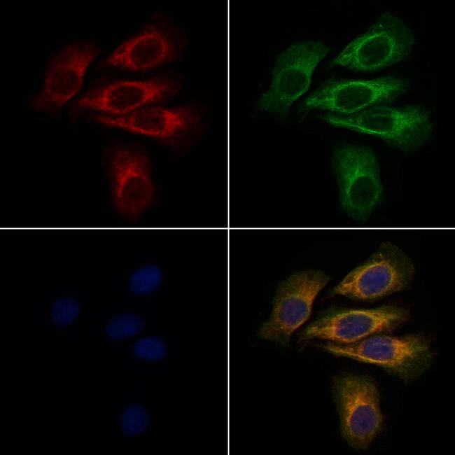 SLC4A1 Antibody in Immunocytochemistry (ICC/IF)