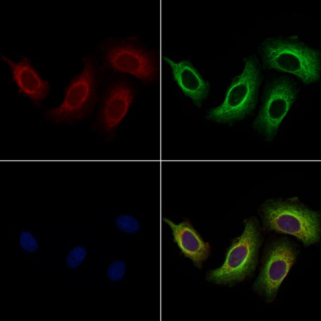 BASP1 Antibody in Immunocytochemistry (ICC/IF)