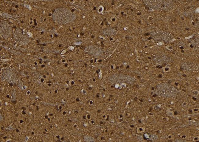 BCL11A Antibody in Immunohistochemistry (Paraffin) (IHC (P))