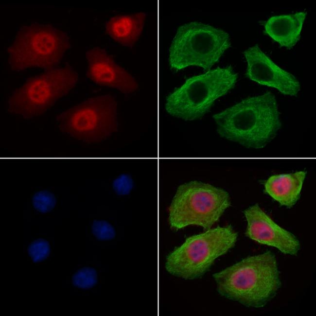 BCL-2 Antibody in Immunocytochemistry (ICC/IF)