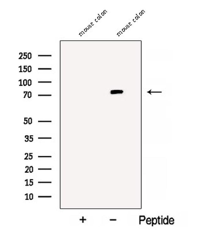 Bestrophin 3 Antibody in Western Blot (WB)