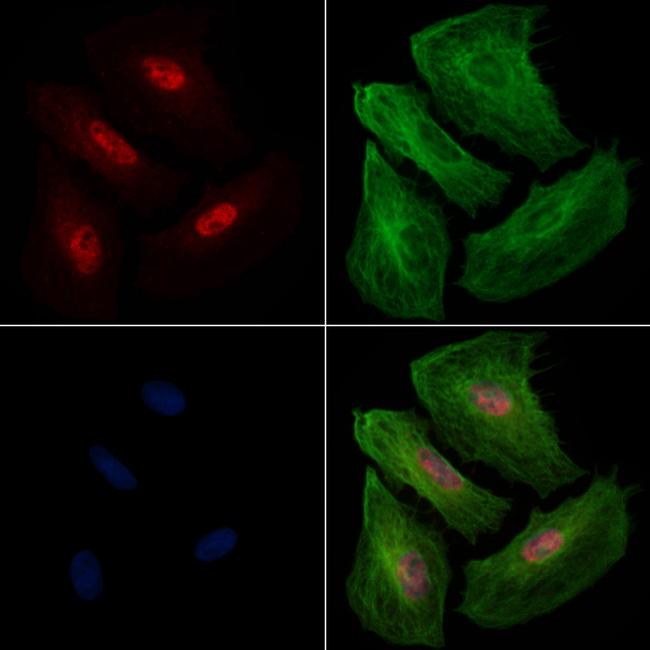 BIRC3 Antibody in Immunocytochemistry (ICC/IF)