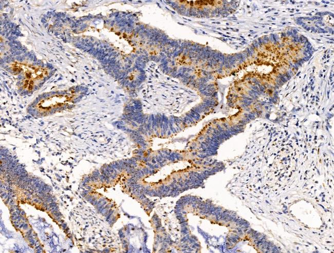 BRUCE Antibody in Immunohistochemistry (Paraffin) (IHC (P))