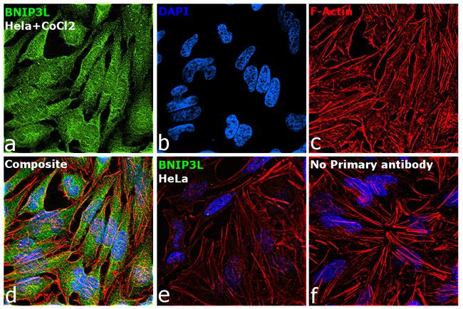 BNIP3L Antibody in Immunocytochemistry (ICC/IF)