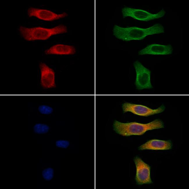 CGRP Antibody in Immunocytochemistry (ICC/IF)