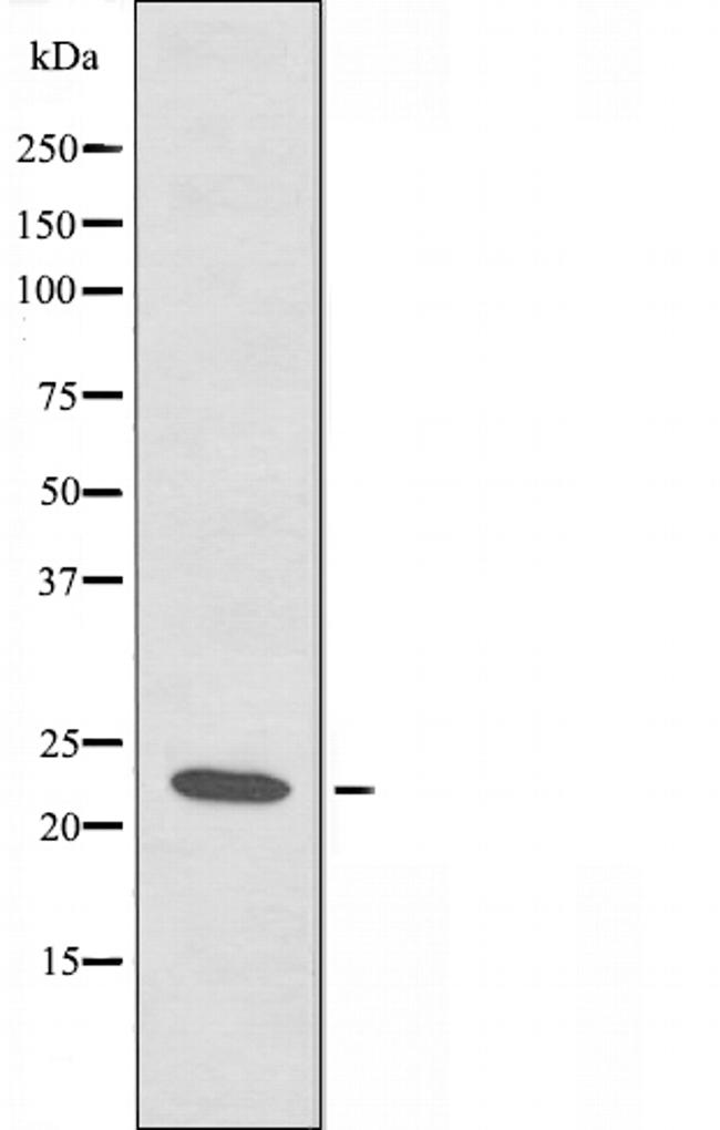 RCAN1 Antibody in Western Blot (WB)