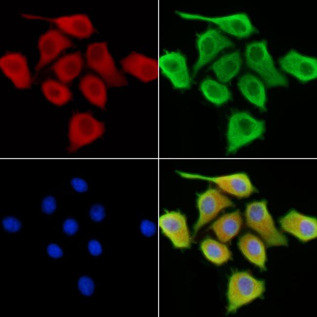 CGRP Antibody in Immunocytochemistry (ICC/IF)