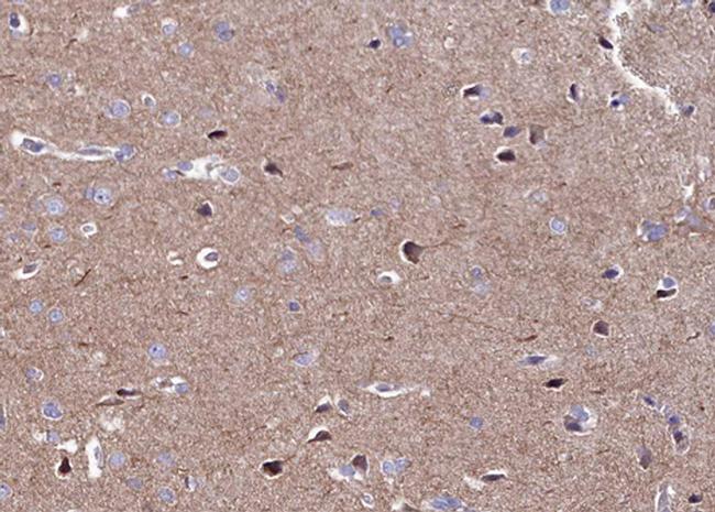 CaMKII alpha/delta Antibody in Immunohistochemistry (Paraffin) (IHC (P))