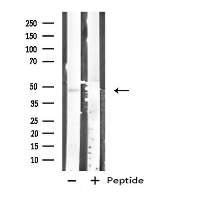 Carboxypeptidase A1 Antibody in Western Blot (WB)