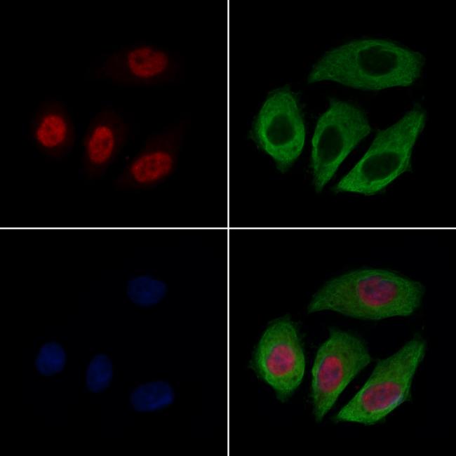 CASC5 Antibody in Immunocytochemistry (ICC/IF)