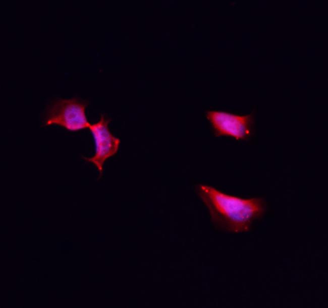 CK1 alpha Antibody in Immunocytochemistry (ICC/IF)