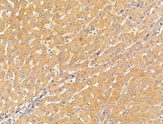 SLC7A1 Antibody in Immunohistochemistry (Paraffin) (IHC (P))