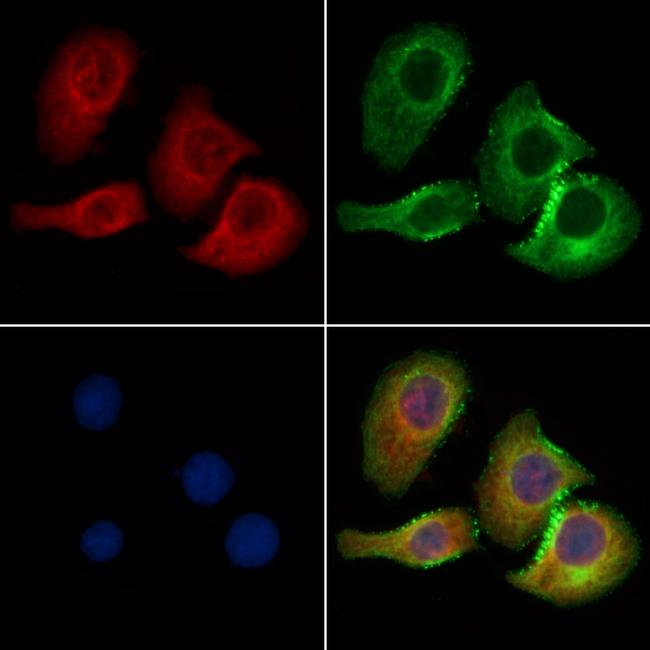 CBX7 Antibody in Immunocytochemistry (ICC/IF)