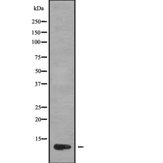 CCL1 Antibody in Western Blot (WB)