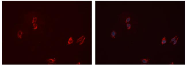 CD32 Antibody in Immunocytochemistry (ICC/IF)