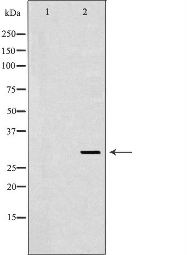 CD154 (CD40 Ligand) Antibody in Western Blot (WB)